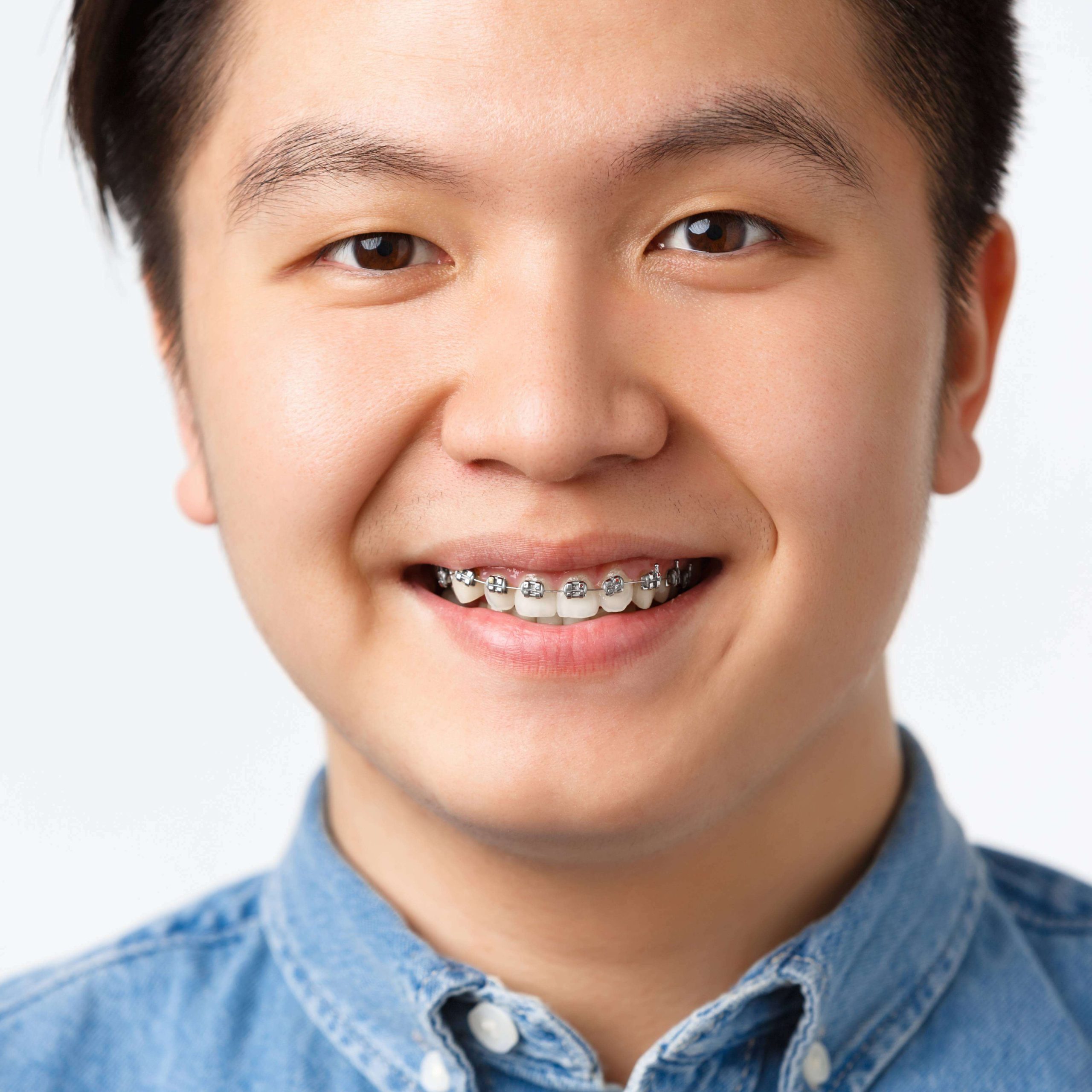 orthodontics-stomatology-concept-headshot-happy-asian-man-smiling-showing-dental-braces-recommend-clinic-satisfied-with-good-results-standing-white-background-pleased
